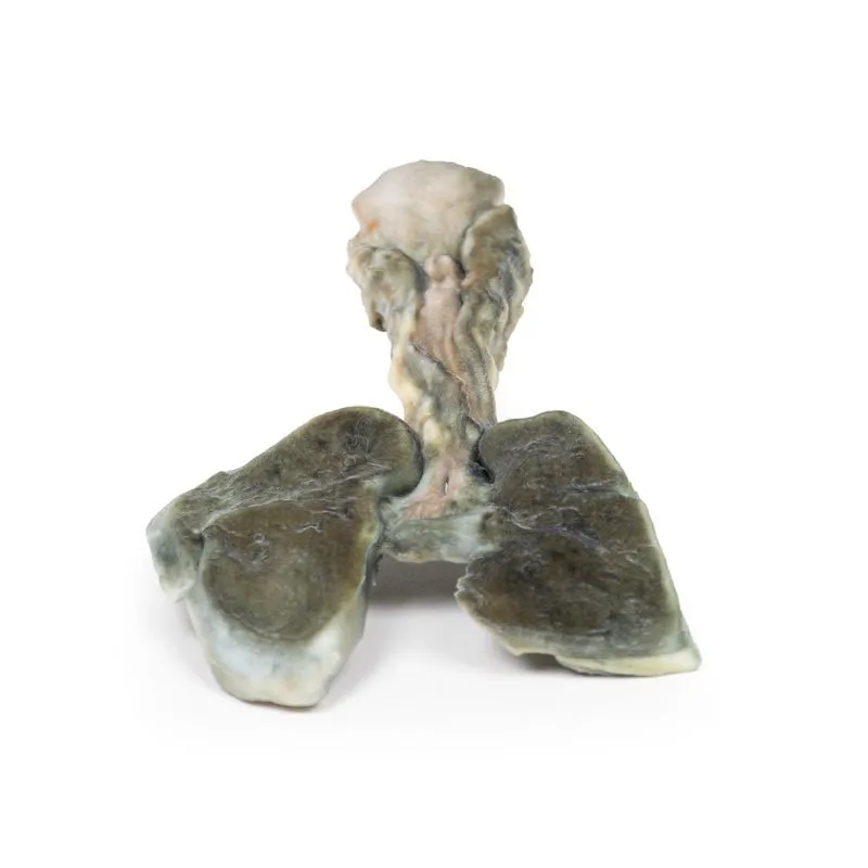 3D Printed Tracheoesophageal Fistula and Oesophagus Atresia